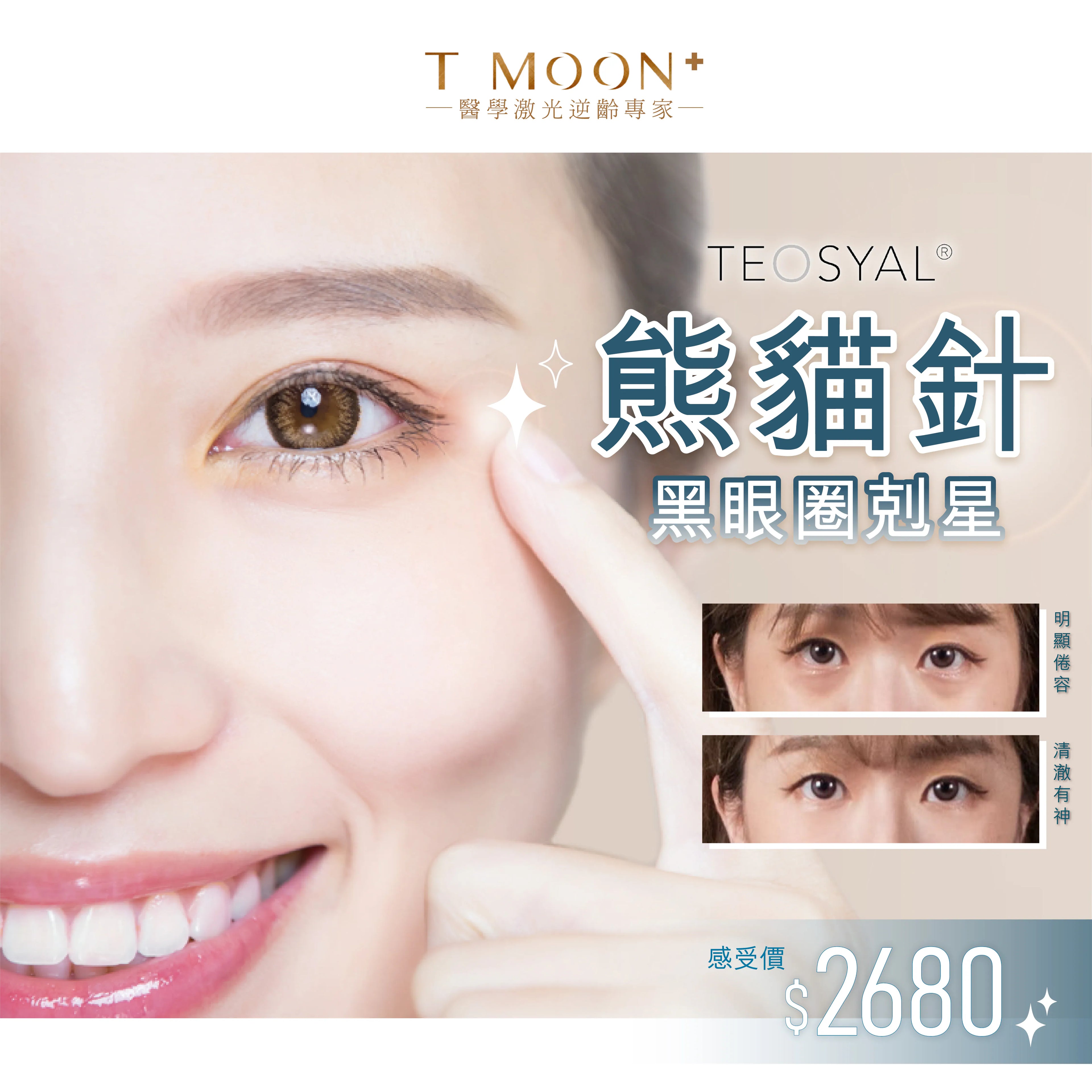 TEOSYAL® REDENSITY 2 熊貓針